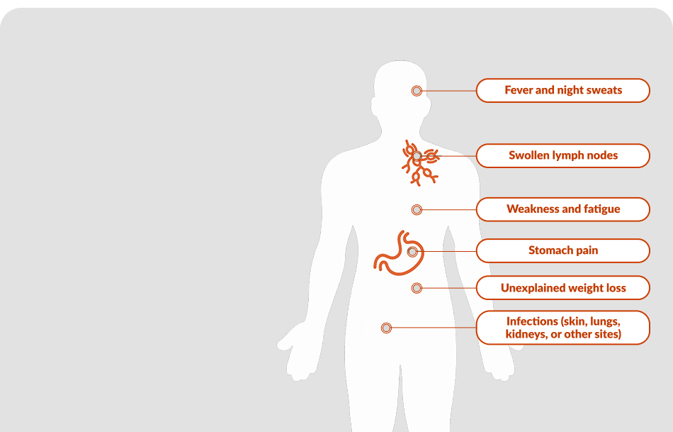 Common Symptoms of Chronic Lymphocytic Leukemia and Small Lymphocytic Lymphoma