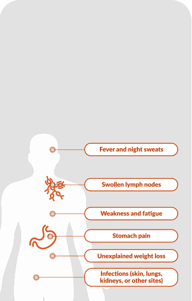 Common Symptoms of Chronic Lymphocytic Leukemia and Small Lymphocytic Lymphoma