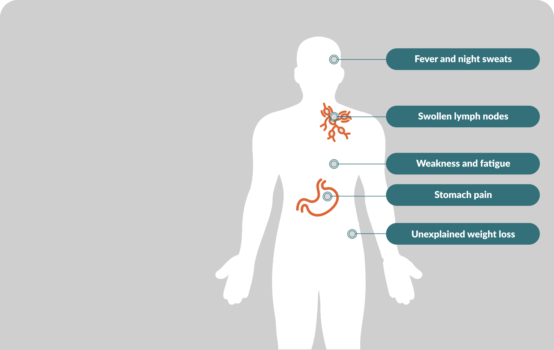 Common Symptoms of Mantle Cell Lymphoma